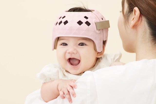 頭蓋矯正ヘルメットを装着した赤ちゃん